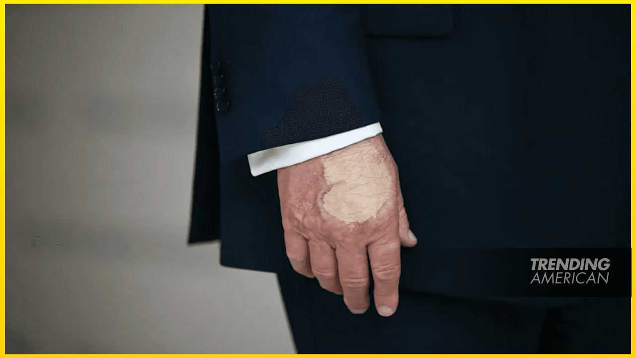 Trump, 79, Slathers On His Trusty Hand Makeup for Christmas