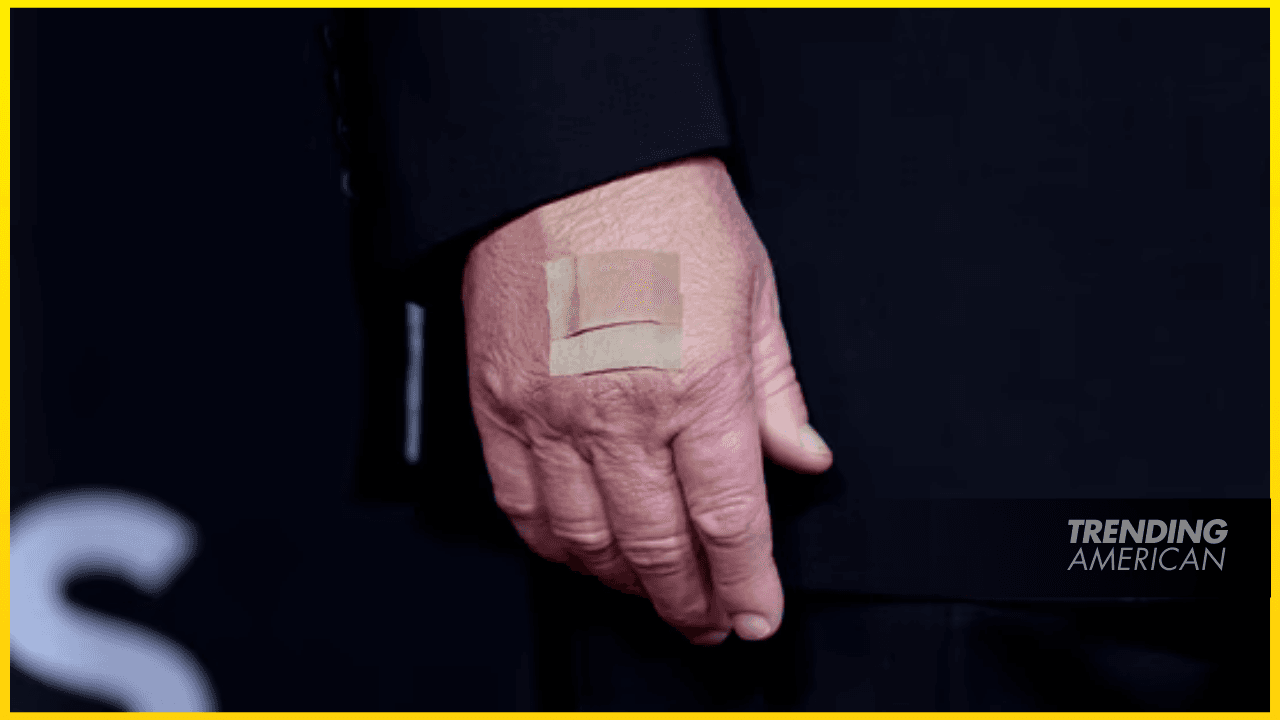 Trump’s Been Covering His Hand With Bandage for a Full Week