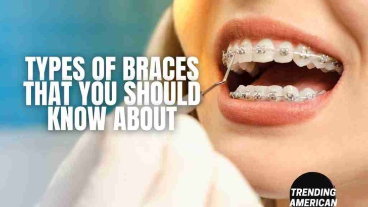 Types of braces that you should know about