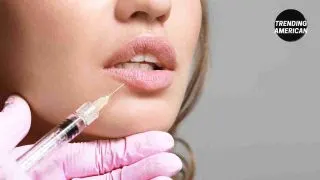 Health And Beauty Redefined: Discover Lip Enhancement Treatments 2023 Welcome to our thorough examination of lip augmentation procedures. Many people want to improve their lips and get a fuller, more defined appearance in today's world of redefined health and aesthetic standards. The ability to attain the ideal lip aesthetics has increased the popularity of lip enhancement operations. In this thorough blog post, we will examine lip enhancement treatments in further detail, revealing the most recent advancements and approaches to hit the market. There are several ways to help you reach your desired lip makeover, whether you're interested in non-surgical methods or surgical operations. Throughout this manual, we'll detail various lip enhancement procedures, their advantages, and any potential drawbacks. But it's important to remember that speaking with a certified medical practitioner or cosmetic surgeon is essential before performing lip augmentation procedures. They will evaluate your needs, review the options, and direct you toward the best course of action for your intended result. Advanced Lip Fillers Image source: Lip fillers made of hyaluronic acid have long been a well-liked alternative. In 2023, cutting-edge formulas and techniques made their debut, offering more extended longevity and effects that look more natural. Notably, lip fillers Leeds provide you with greater control over the quantity and positioning of the product, enabling more precise customization and a more harmonious lip appearance. Additionally, some contemporary lip fillers could include various ingredients like antioxidants or growth factors that help the skin's health and collagen synthesis. Lip Augmentation with Autologen Lip fillers called autologous collagen injections are made of human collagen from the patient's skin. Collagen cells from the patient are harvested and stored throughout this surgery to be injected up to five years from now. Since autologin is a biological substance that naturally occurs in the body and cannot be rejected, it is thought to be the safest and the most realistic-looking filler material for lip augmentations. Non-Surgical Lip Lift People looking for a non-invasive way to improve their lips increasingly choose non-surgical lip lift procedures. Dermal fillers can be precisely injected around the mouth to elevate and shape lips, giving them a fuller and younger appearance. This technique can correct asymmetries, add volume to the lips, and redraw the lip line. Non-surgical lip lifts are a popular option for those who would rather avoid surgery because they frequently have little recovery time and temporary results. Thread Lifts for Lips Image source: Thread lifts, intended initially to rejuvenate the face, have recently been repurposed for lip enlargement. This novel procedure includes putting dissolvable threads into the lips, which lift and define their contour. Thread lifts can create a more pronounced cupid's bow, improve lip symmetry, and increase volume subtly yet noticeably. Furthermore, the threads stimulate collagen formation, providing long-term benefits even after the threads dissolve. Lip Augmentation with SMAS Implant Image source: SMAS implants are used to augment the lips in conjunction with sub-SMAS facelifts, a facelift method that was created in the 1980s. The SMAS (superficial musculoaponeurotic system) is the lowest layer of tissue within the skin and subcutaneous tissue that separates the facial skin from the facial muscles. The sub-SMAS facelift procedure is intended to preserve the structure of the SMAS. To add volume, the superficial musculoaponeurotic system's natural fat, collagen, and fibrous tissue are removed from the lips during lip augmentation with SMAS implants. This lip augmentation treatment has minimal recovery time and produces results that last a very long period. Lip Microblading Lip microblading, inspired by the famous eyebrow microblading method, has evolved as a semi-permanent solution for lip enhancement. This treatment, which uses semi-permanent pigments, can reconfigure the lip contour, enhance volume, and rectify asymmetry. Lip microblading produces a natural-looking finish that resembles giant lips. The process requires little upkeep, making it an intriguing option for those looking for long-term but non-permanent improvements. Laser Lip Rejuvenation Image source: A technique called laser lip rejuvenation employs laser technology to enhance the lips. Concerns about fine lines, wrinkles, and lip discoloration are addressed by this procedure. Laser treatments increase collagen formation, resulting in a more youthful appearance and improving lip texture and overall appearance. The downtime associated with laser lip rejuvenation is often minimal, and it can be customized to each patient's needs. Bottomline Treatments for lip augmentation have advanced tremendously, giving people many possibilities to reshape their lips and improve their overall appearance. This blog post examined the numerous lip augmentation procedures that are now offered, giving you a thorough review of your alternatives. There are options to fit various preferences and desired results, from the widely used hyaluronic acid and other modern lip fillers to non-surgical procedures like lip lifts and thread lifts. Additionally, cutting-edge methods to improve lip volume, shape, and texture have evolved, including lip microblading and laser lip rejuvenation. It's vital to remember that lip augmentation is a personal decision, and speaking with a knowledgeable healthcare provider or cosmetic surgeon is essential before considering any therapy. They may evaluate your particular requirements, review the available choices, and assist you in coming to a conclusion that aligns with your objectives and expectations.