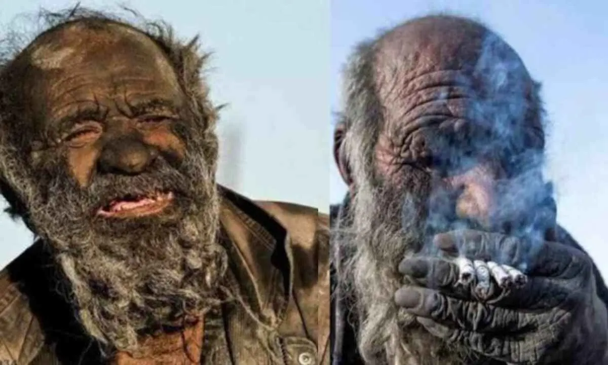 World's Dirtiest Man Has Not Showered For 60 Years Shocking Events A Few Months After His First Bath!