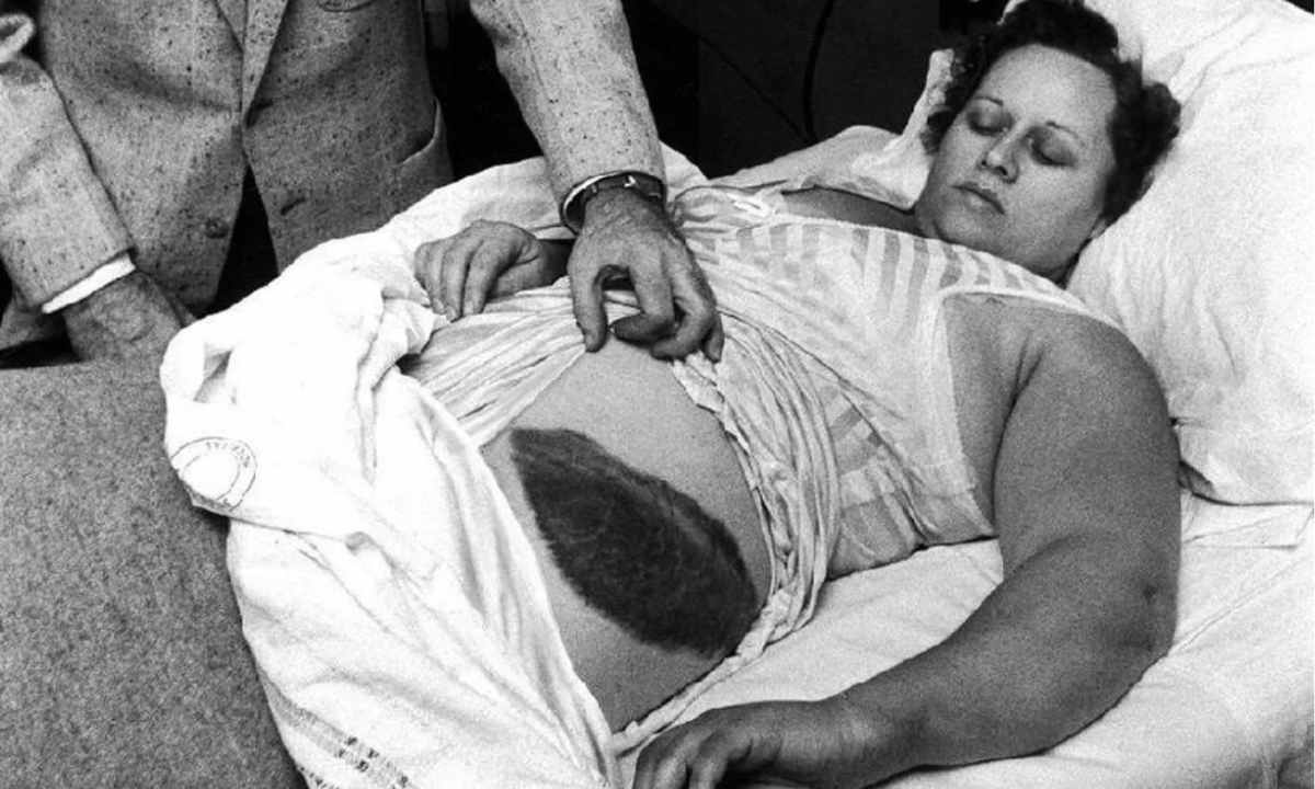 This Is The Only Person In History To Be Hit By A Meteorite!