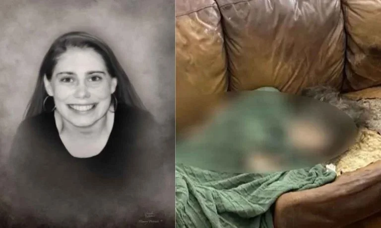 This Woman Was ‘Melted’ Into Couch