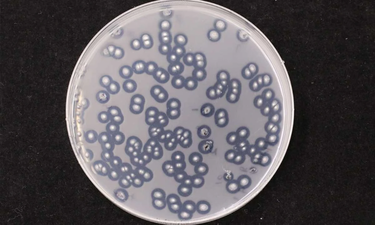 Scientists Discover A Fungus That Eats Plastic In The Dark and Turns It Into Food!